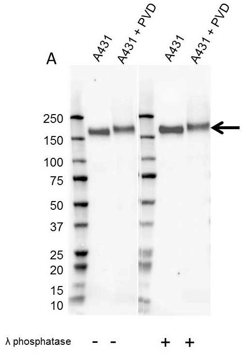 Anti EGF Receptor Antibody (PrecisionAb Monoclonal Antibody) gallery image 1