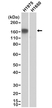 Anti EGF R (L858R Mutant) Antibody, clone RM380 thumbnail image 1