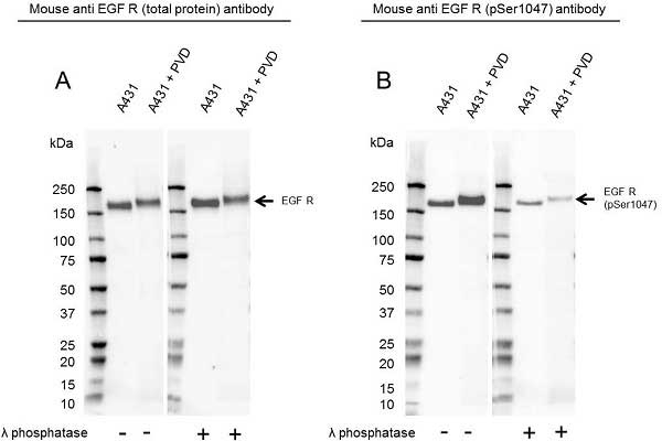 Anti EGF Receptor (pSer1047) Antibody (PrecisionAb Monoclonal Antibody) gallery image 1
