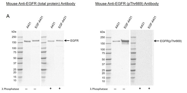 Anti EGF Receptor (pThr669) Antibody, clone EF02-2C12 (PrecisionAb Monoclonal Antibody) gallery image 1