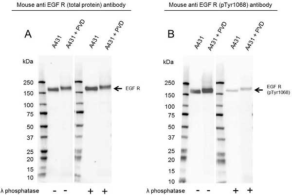 Anti EGF Receptor (pTyr1068) Antibody (PrecisionAb Monoclonal Antibody) gallery image 1