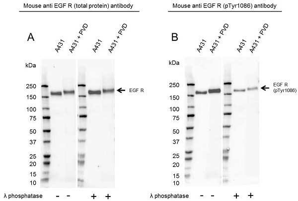 Anti EGF Receptor (pTyr1086) Antibody (PrecisionAb Monoclonal Antibody) gallery image 1