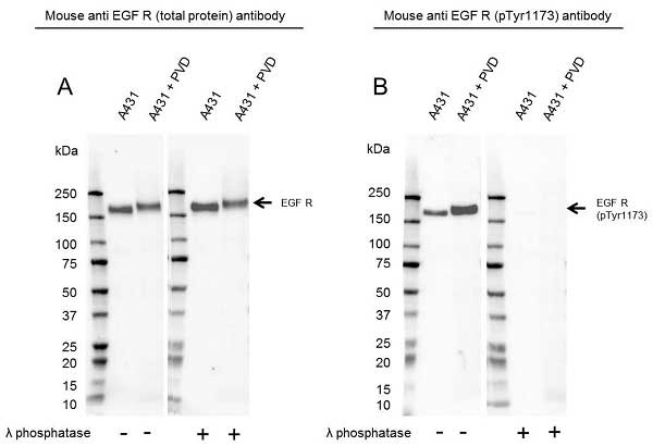 Anti EGF Receptor (pTyr1173) Antibody (PrecisionAb Monoclonal Antibody) gallery image 1