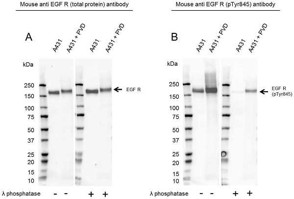 Anti EGF Receptor (pTyr845) Antibody (PrecisionAb Monoclonal Antibody) gallery image 1