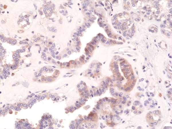 Anti EIF2S1 (pSer51) Antibody, clone RM298 gallery image 3