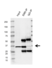 Anti EMD Antibody, clone AB01/4H6 (PrecisionAb Monoclonal Antibody) thumbnail image 2