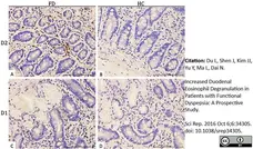 Anti Human Eosinophil Major Basic Protein Antibody, clone BMK-13 gallery image 1
