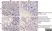 Anti Human Eosinophil Major Basic Protein Antibody, clone BMK-13 thumbnail image 1