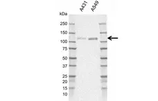 Anti Human EPHA2 Antibody, clone rL02/4G6 gallery image 1