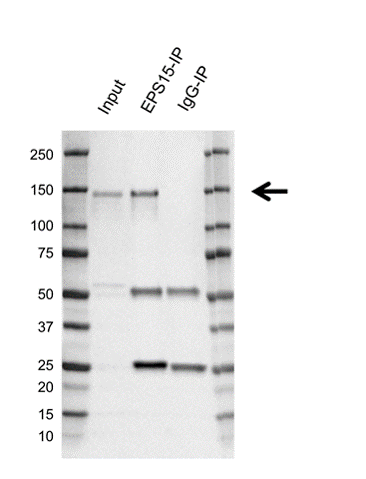 Anti EPS15 Antibody, clone CD01/1C2 (PrecisionAb Monoclonal Antibody) gallery image 2