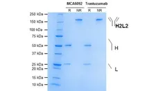 Anti ErbB2 (Trastuzumab Biosimilar) Antibody, clone 4D5-8 gallery image 1