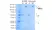 Anti ErbB2 (Trastuzumab Biosimilar) Antibody, clone 4D5-8 thumbnail image 1