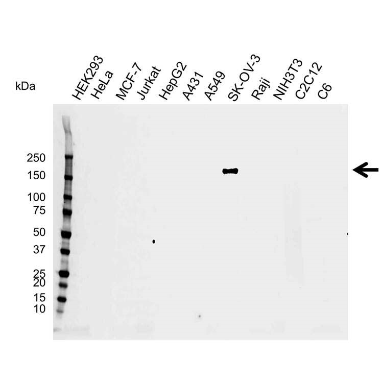 Anti ErbB2 Antibody, clone AB04/4D7 (PrecisionAb Monoclonal Antibody) gallery image 1