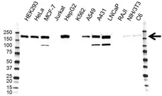 Anti ErbB2 Antibody, clone OTI4F10 (PrecisionAb Monoclonal Antibody) gallery image 1