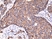 Anti ErbB2 Antibody, clone RM228 thumbnail image 1
