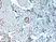 Anti Human Estrogen Receptor Alpha Antibody, clone 6F11 thumbnail image 1