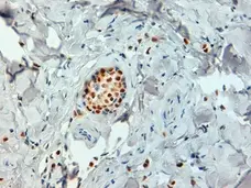 Anti Human Estrogen Receptor Alpha Antibody, clone 6F11 gallery image 2