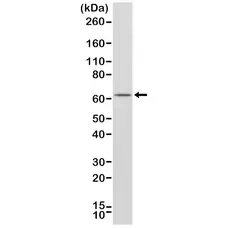 Anti Estrogen Receptor Alpha Antibody, clone RM292 gallery image 1