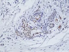 Anti Estrogen Receptor Alpha Antibody, clone RM292 gallery image 2