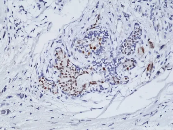 Anti Estrogen Receptor Alpha Antibody, clone RM292 gallery image 2