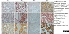 Anti Human Estrogen Receptor Beta 1 Antibody, clone PPG5/10 gallery image 1
