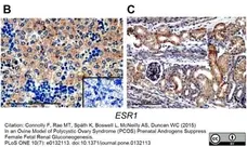 Anti Human Estrogen Receptor Beta 1 Antibody, clone PPG5/10 gallery image 10