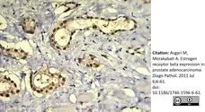 Anti Human Estrogen Receptor Beta 1 Antibody, clone PPG5/10 gallery image 11