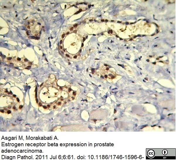 Anti Human Estrogen Receptor Beta 1 Antibody, clone PPG5/10 gallery image 11