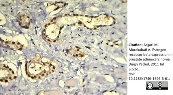 Anti Human Estrogen Receptor Beta 1 Antibody, clone PPG5/10 gallery image 11