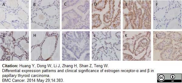 Anti Human Estrogen Receptor Beta 1 Antibody, clone PPG5/10 gallery image 12