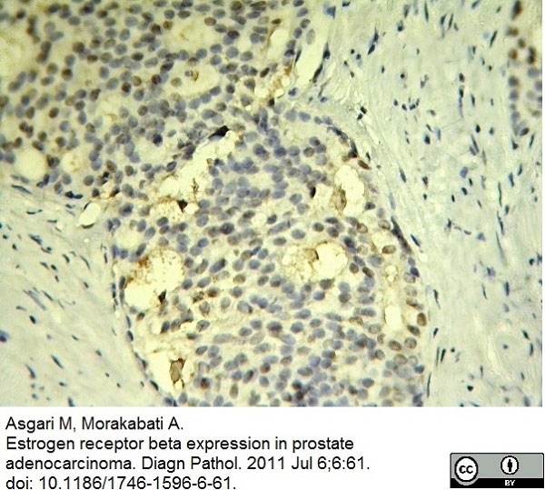Anti Human Estrogen Receptor Beta 1 Antibody, clone PPG5/10 gallery image 14
