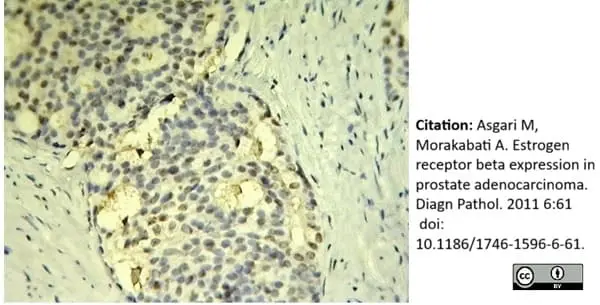 Anti Human Estrogen Receptor Beta 1 Antibody, clone PPG5/10 gallery image 14