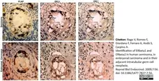 Anti Human Estrogen Receptor Beta 1 Antibody, clone PPG5/10 gallery image 15