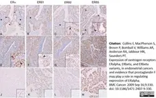 Anti Human Estrogen Receptor Beta 1 Antibody, clone PPG5/10 gallery image 16