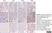 Anti Human Estrogen Receptor Beta 1 Antibody, clone PPG5/10 thumbnail image 16