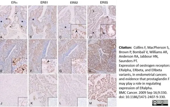 Anti Human Estrogen Receptor Beta 1 Antibody, clone PPG5/10 gallery image 16