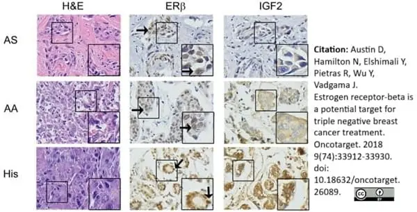 Anti Human Estrogen Receptor Beta 1 Antibody, clone PPG5/10 gallery image 17