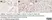 Anti Human Estrogen Receptor Beta 1 Antibody, clone PPG5/10 thumbnail image 18