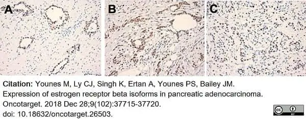 Anti Human Estrogen Receptor Beta 1 Antibody, clone PPG5/10 gallery image 18