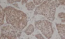 Anti Human Estrogen Receptor Beta 1 Antibody, clone PPG5/10 gallery image 2