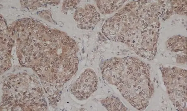 Anti Human Estrogen Receptor Beta 1 Antibody, clone PPG5/10 gallery image 2