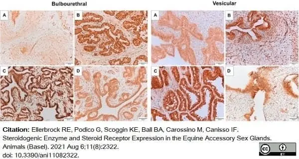 Anti Human Estrogen Receptor Beta 1 Antibody, clone PPG5/10 gallery image 20