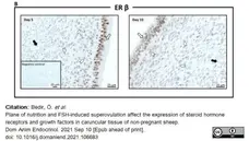 Anti Human Estrogen Receptor Beta 1 Antibody, clone PPG5/10 gallery image 21