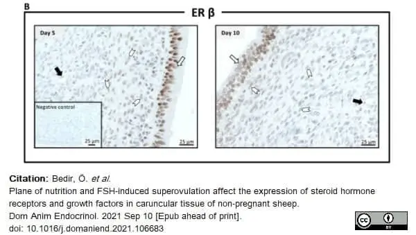 Anti Human Estrogen Receptor Beta 1 Antibody, clone PPG5/10 gallery image 21