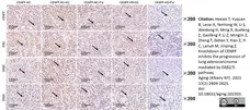 Anti Human Estrogen Receptor Beta 1 Antibody, clone PPG5/10 gallery image 22