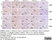 Anti Human Estrogen Receptor Beta 1 Antibody, clone PPG5/10 thumbnail image 22