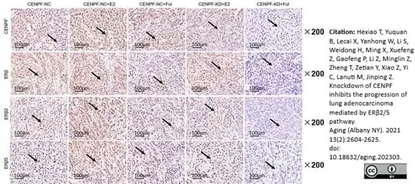 Anti Human Estrogen Receptor Beta 1 Antibody, clone PPG5/10 gallery image 22