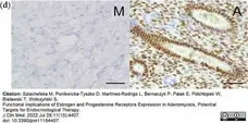 Anti Human Estrogen Receptor Beta 1 Antibody, clone PPG5/10 gallery image 23
