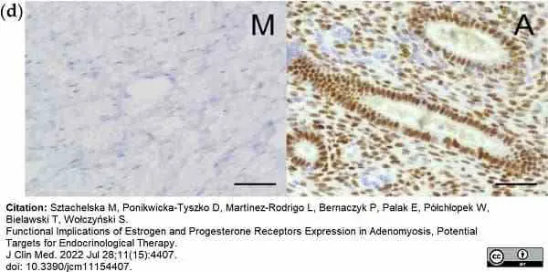 Anti Human Estrogen Receptor Beta 1 Antibody, clone PPG5/10 gallery image 23