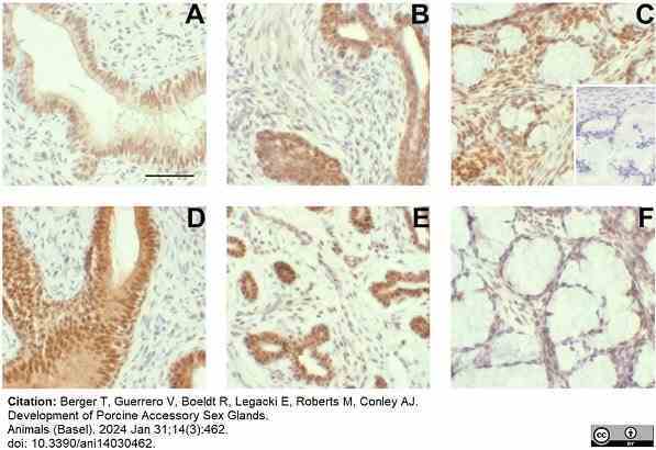 Anti Human Estrogen Receptor Beta 1 Antibody, clone PPG5/10 gallery image 24